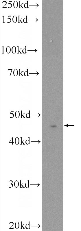 K-562 cells were subjected to SDS PAGE followed by western blot with Catalog No:107995(ACY1 Antibody) at dilution of 1:600