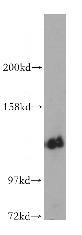 PC-3 cells were subjected to SDS PAGE followed by western blot with Catalog No:114102(PPP2R3A antibody) at dilution of 1:300