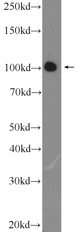 A431 cells were subjected to SDS PAGE followed by western blot with Catalog No:109841(DDX58 Antibody) at dilution of 1:600