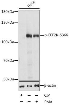 Western blot - Phospho-EEF2K-S366 pAb 