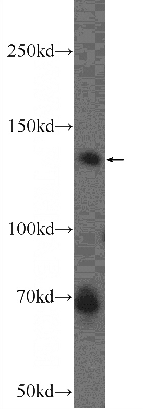 HEK-293 cells were subjected to SDS PAGE followed by western blot with Catalog No:108078(ANKRD50 Antibody) at dilution of 1:300