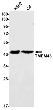 Western blot detection of TMEM43 in K562,C6 cell lysates using TMEM43 Rabbit mAb(1:1000 diluted).Predicted band size:45kDa.Observed band size:45kDa.