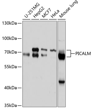 Western blot - PICALM Polyclonal Antibody 