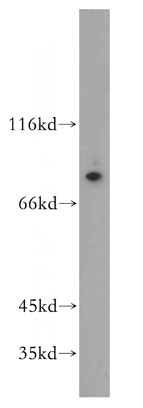 human placenta tissue were subjected to SDS PAGE followed by western blot with Catalog No:110893(GBP4 antibody) at dilution of 1:600