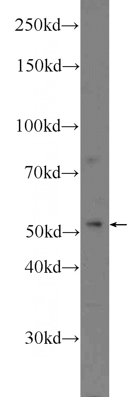 A549 cells were subjected to SDS PAGE followed by western blot with Catalog No:112244(LIPI Antibody) at dilution of 1:300