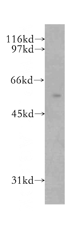 mouse lung tissue were subjected to SDS PAGE followed by western blot with Catalog No:116931(ZC3HC1 antibody) at dilution of 1:500