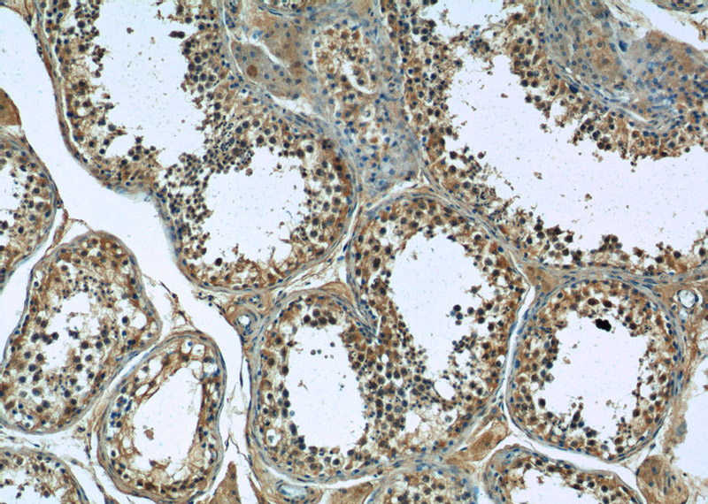 Immunohistochemistry of paraffin-embedded human testis tissue slide using Catalog No:115396(SMO Antibody) at dilution of 1:50 (under 10x lens)