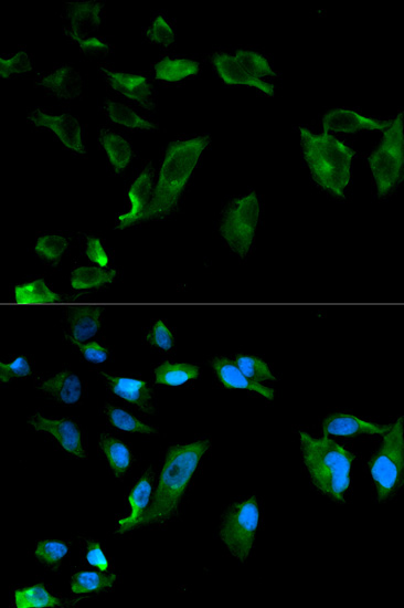 Immunofluorescence - NEK8 Polyclonal Antibody 
