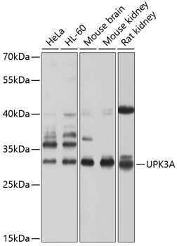 Western blot - UPK3A Polyclonal Antibody 