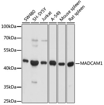Western blot - MADCAM1 Polyclonal Antibody 