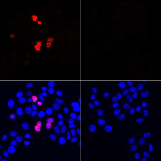 Immunofluorescence - Rabbit anti DDDDK-Tag pAb 