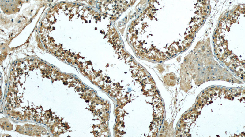 Immunohistochemistry of paraffin-embedded human testis slide using Catalog No:107607(STMN1 Antibody) at dilution of 1:50