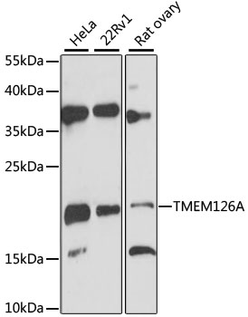 Western blot - TMEM126A Polyclonal Antibody 