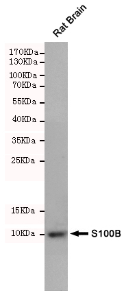 Western blot analysis of extracts from Rat Brain cell lysates using S100B mouse mAb (1:500 diluted).Predicted band size:10kDa.Observed band size:10kDa.