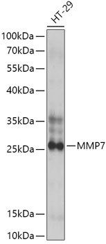 Western blot - MMP7 Polyclonal Antibody 