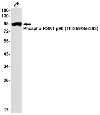 Western blot detection of Phospho-RSK1 p90 (Thr359/Ser363) in C6 cell lysates using Phospho-RSK1 p90 (Thr359/Ser363) Rabbit mAb(1:1000 diluted).Predicted band size:83kDa.Observed band size:90kDa.