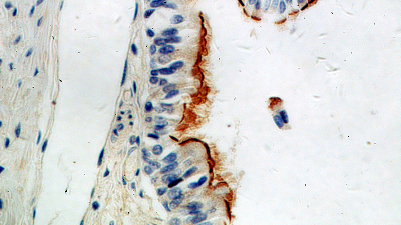 Immunohistochemical of paraffin-embedded human lung using Catalog No:115921(TCTN3 antibody) at dilution of 1:50 (under 40x lens)