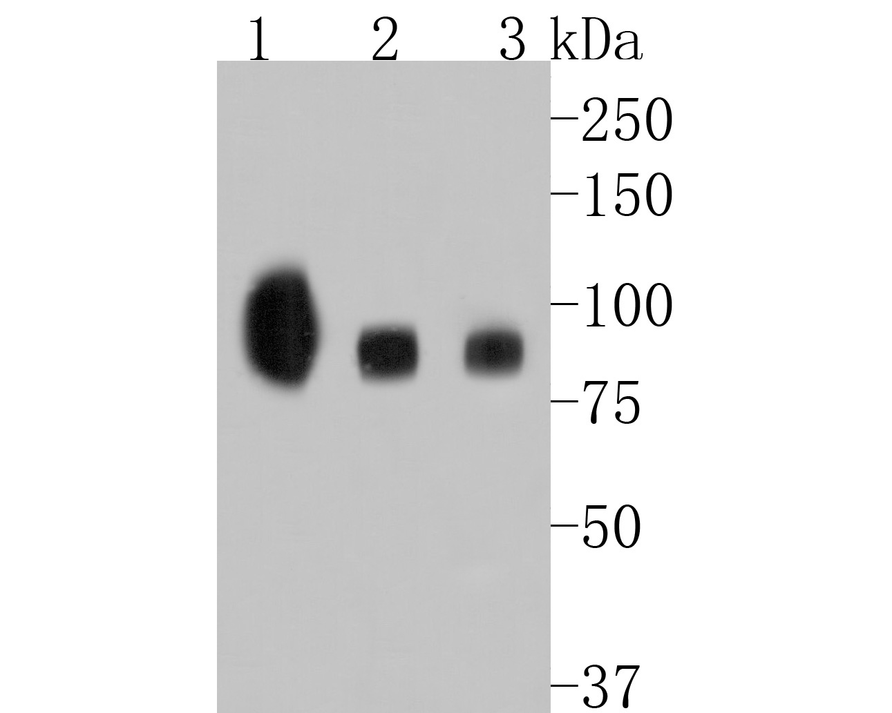 Fig1:; Western blot analysis of TrkB on different lysates. Proteins were transferred to a PVDF membrane and blocked with 5% BSA in PBS for 1 hour at room temperature. The primary antibody ( 1/500) was used in 5% BSA at room temperature for 2 hours. Goat Anti-Rabbit IgG - HRP Secondary Antibody (HA1001) at 1:5,000 dilution was used for 1 hour at room temperature.; Positive control:; Lane 1: mouse brain tissue lysate; Lane 2: mouse cerebellum tissue lysate; Lane 3: rat cerebellum tissue lysate
