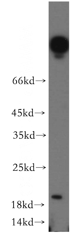 HeLa cells were subjected to SDS PAGE followed by western blot with Catalog No:116525(UBE2G1 antibody) at dilution of 1:100