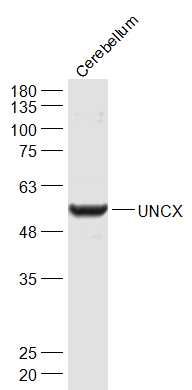 Fig6: Sample:; Cerebellum (Mouse) Lysate at 40 ug; Primary: Anti-UNCX at 1/1000 dilution; Secondary: IRDye800CW Goat Anti-Rabbit IgG at 1/20000 dilution; Predicted band size: 54 kD; Observed band size: 55 kD
