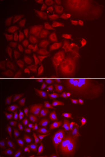 Immunofluorescence - TRAPPC10 Polyclonal Antibody 