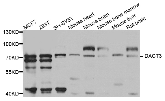 Western blot - DACT3 Polyclonal Antibody 