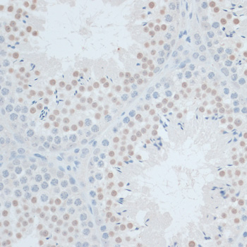 Immunohistochemistry - ZNF446 Polyclonal Antibody 