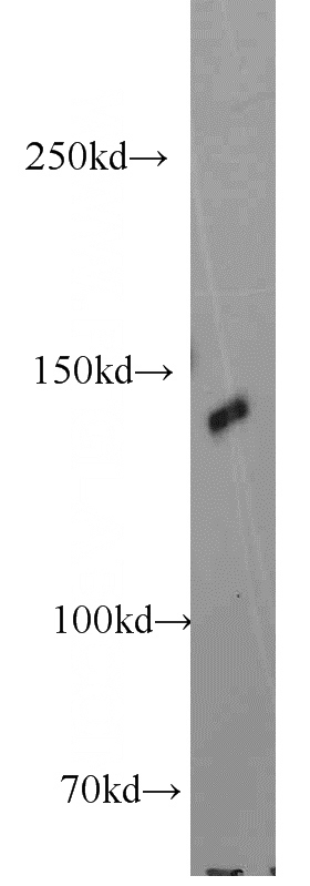 HeLa cells were subjected to SDS PAGE followed by western blot with Catalog No:113000(MYPN-Specific antibody) at dilution of 1:300