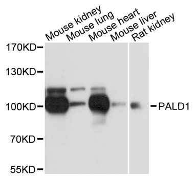 Western blot - PALD1 Polyclonal Antibody 