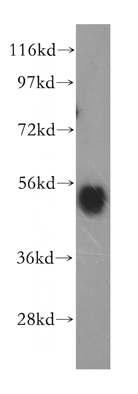 mouse lung tissue were subjected to SDS PAGE followed by western blot with Catalog No:117125(ARRB1 antibody) at dilution of 1:500