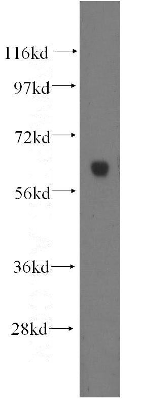 human heart tissue were subjected to SDS PAGE followed by western blot with Catalog No:111576(HYAL2 antibody) at dilution of 1:300