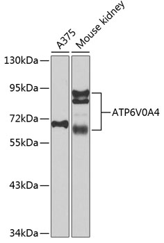 Western blot - ATP6V0A4 Polyclonal Antibody 