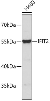 Western blot - IFIT2 Polyclonal Antibody 