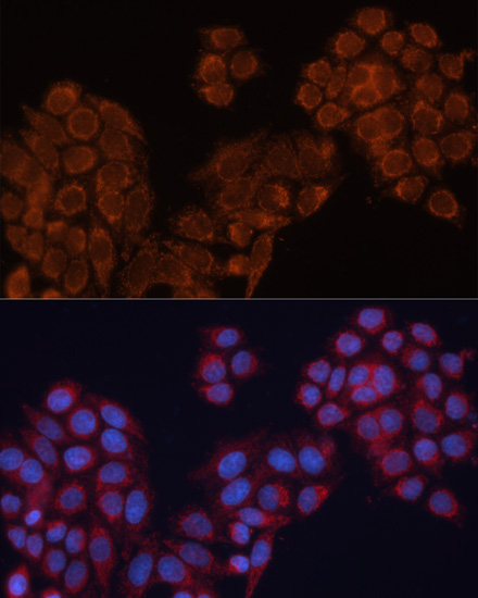 Immunofluorescence - ALDH6A1 Polyclonal Antibody 