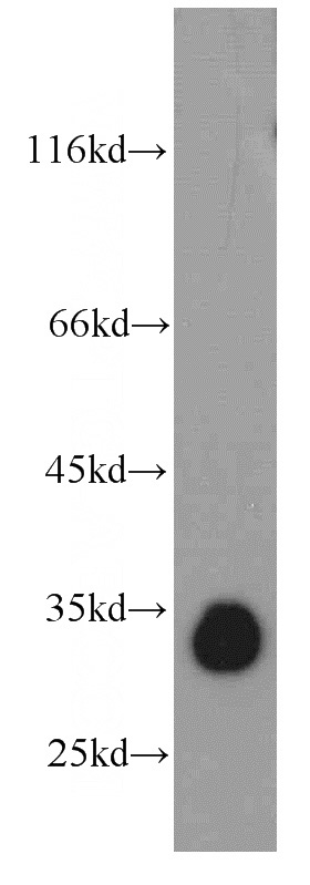 mouse brain tissue were subjected to SDS PAGE followed by western blot with Catalog No:111983(KIAA0513 antibody) at dilution of 1:500