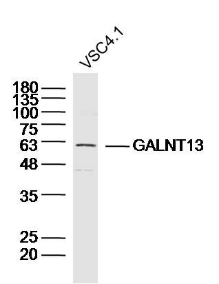 Fig1: Sample:VSC4.1 Cell (Rat) Lysate at 40 ug; Primary: Anti-GALNT13 at 1/300 dilution; Secondary: IRDye800CW Goat Anti-Rabbit IgG at 1/20000 dilution; Predicted band size: 64kD; Observed band size: 62kD