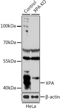 Western blot - XPA Polyclonal Antibody 