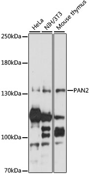 Western blot - PAN2 Polyclonal Antibody 