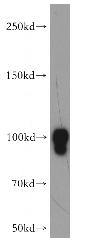 mouse brain tissue were subjected to SDS PAGE followed by western blot with Catalog No:110129(DNM1 antibody) at dilution of 1:2000