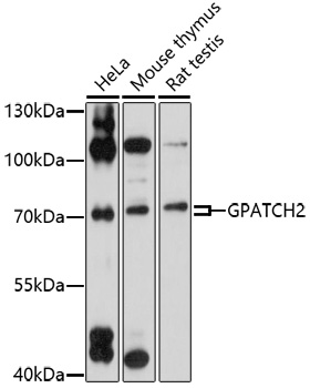 Western blot - GPATCH2 Polyclonal Antibody 