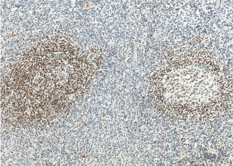 Immunohistochemistry of paraffin-embedded human tonsillitis tissue slide using Catalog No:117248(BSAP,PAX5 Antibody) at dilution of 1:100 (under 10x lens). heat mediated antigen retrieved with Sodium Citrate buffer (pH6).