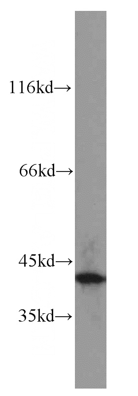 human brain tissue were subjected to SDS PAGE followed by western blot with Catalog No:110434(FA2H antibody) at dilution of 1:600