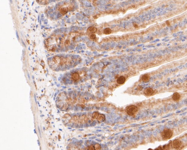 Fig7: Immunohistochemical analysis of paraffin-embedded Mouse colon tissue using anti-Gasdermin D antibody. The section was pre-treated using heat mediated antigen retrieval with sodium citrate buffer (pH 6.0) for 20 minutes. The tissues were blocked in 5