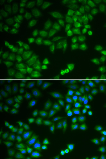 Immunofluorescence - RPL5 Polyclonal Antibody 
