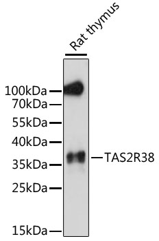 Western blot - TAS2R38 Polyclonal Antibody 