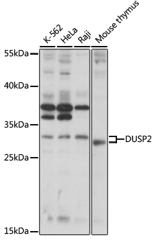 Western blot - DUSP2 Polyclonal Antibody 