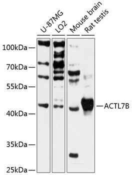Western blot - ACTL7B Polyclonal Antibody 