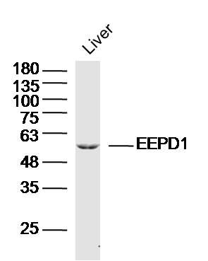 Fig1: Sample: Liver (Mouse) Lysate at 40 ug; Primary: Anti-EEPD1 at 1/300 dilution; Secondary: IRDye800CW Goat Anti-Rabbit IgG at 1/20000 dilution; Predicted band size: 62 kD; Observed band size: 60 kD