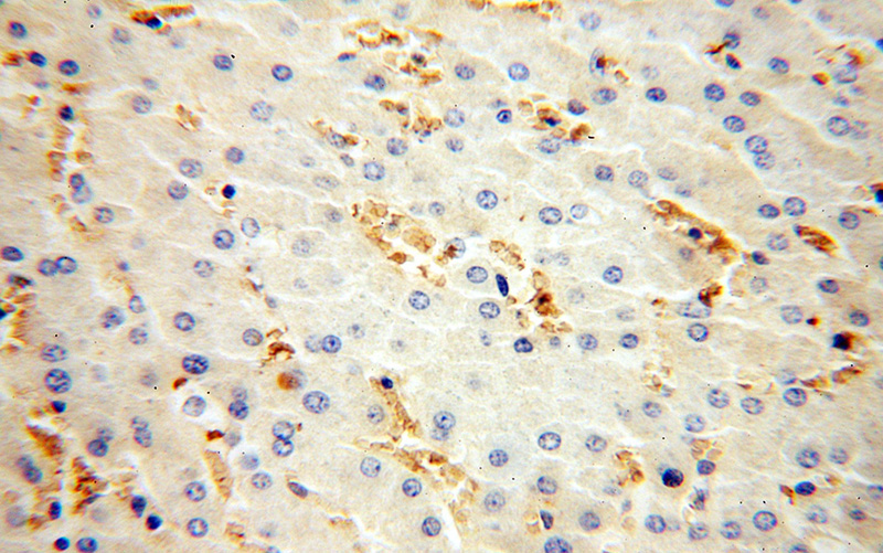Immunohistochemical of paraffin-embedded human liver using Catalog No:111267(HBD antibody) at dilution of 1:100 (under 40x lens)