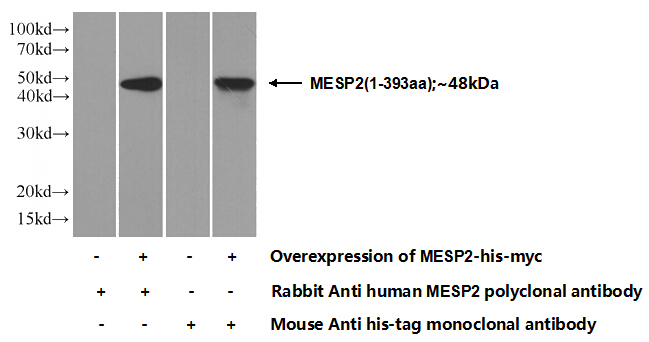Transfected HEK-293 cells were subjected to SDS PAGE followed by western blot with Catalog No:112511(MESP2 Antibody) at dilution of 1:1000